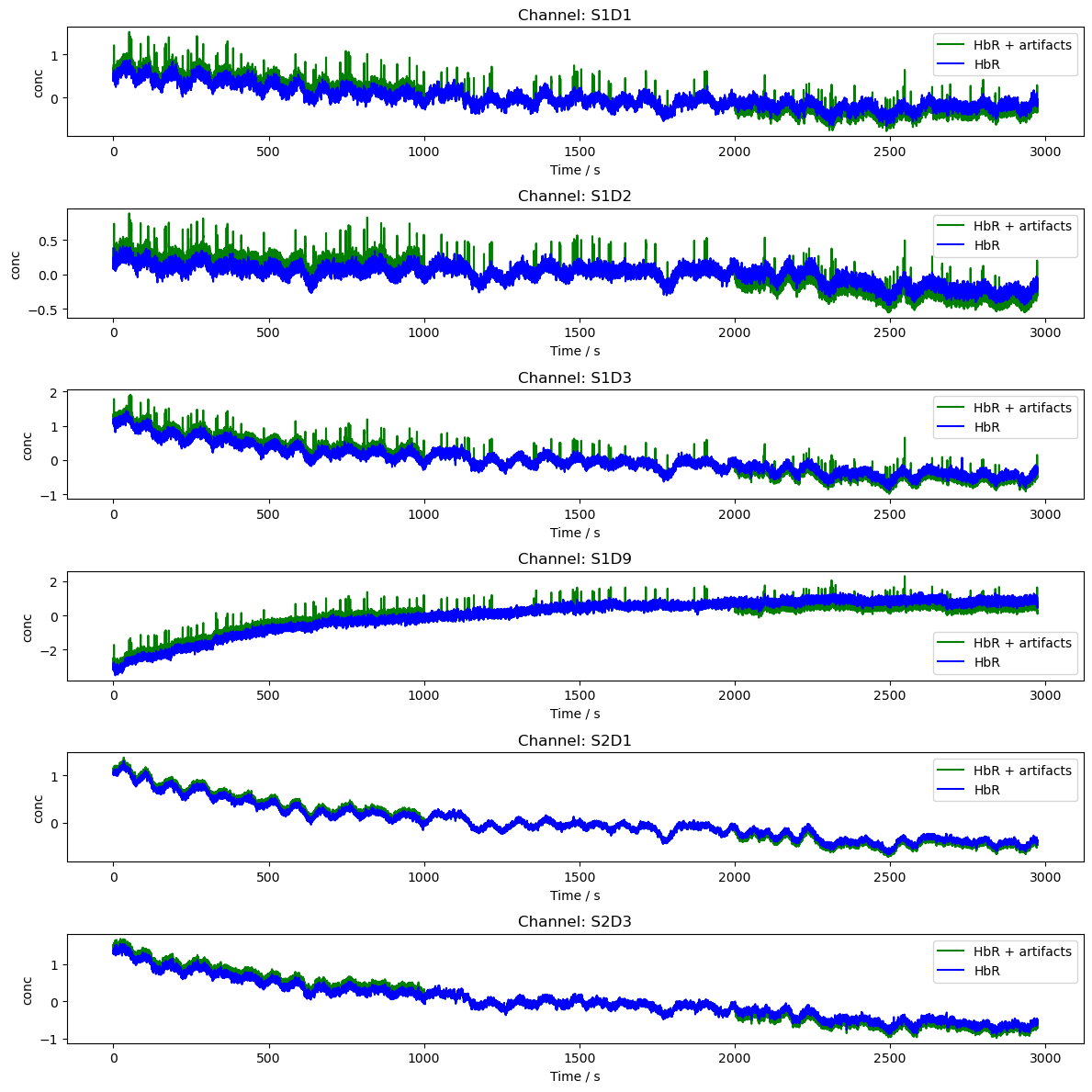 ../../_images/examples_augmentation_61_synthetic_artifacts_example_10_0.png
