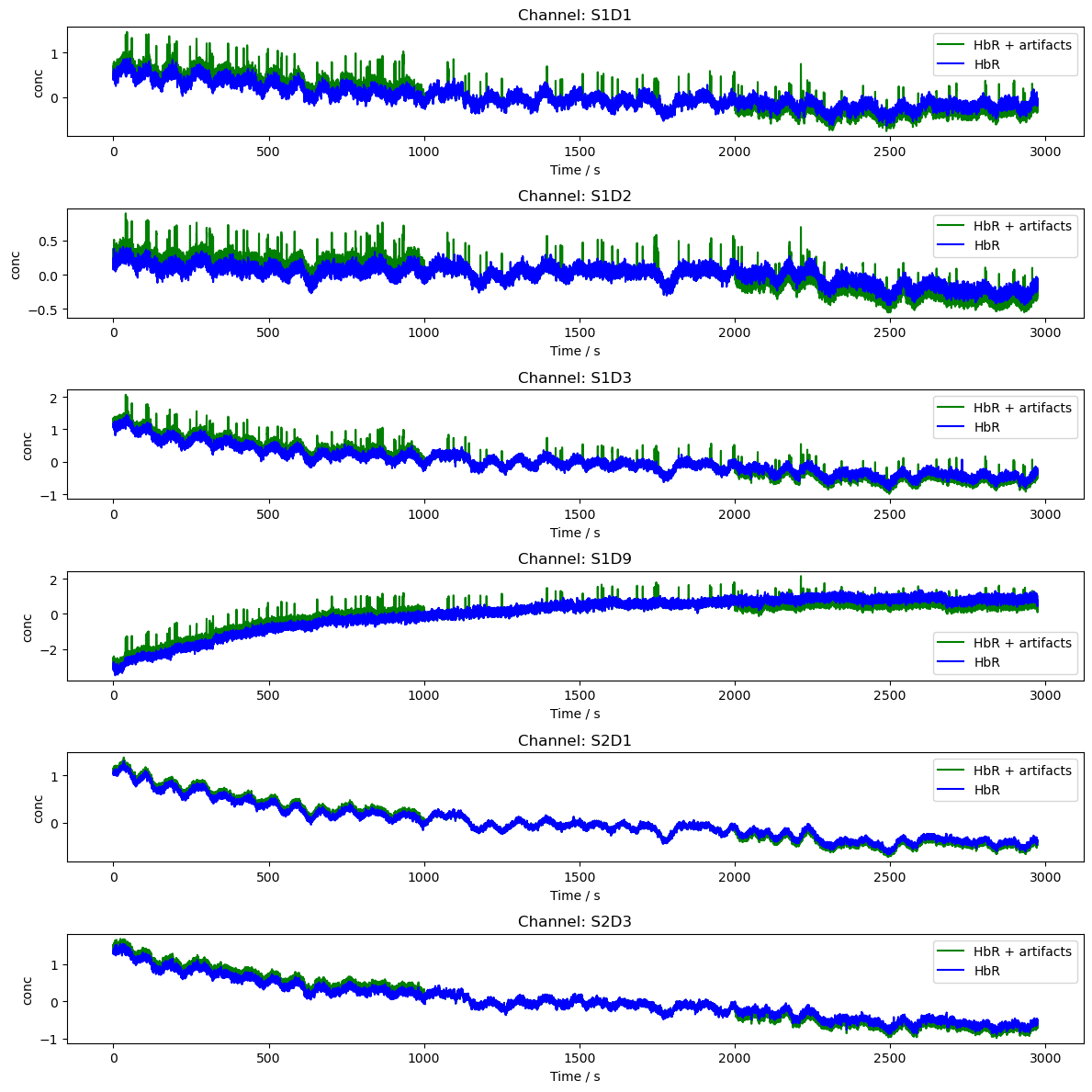 ../../_images/examples_augmentation_61_synthetic_artifacts_example_11_0.png