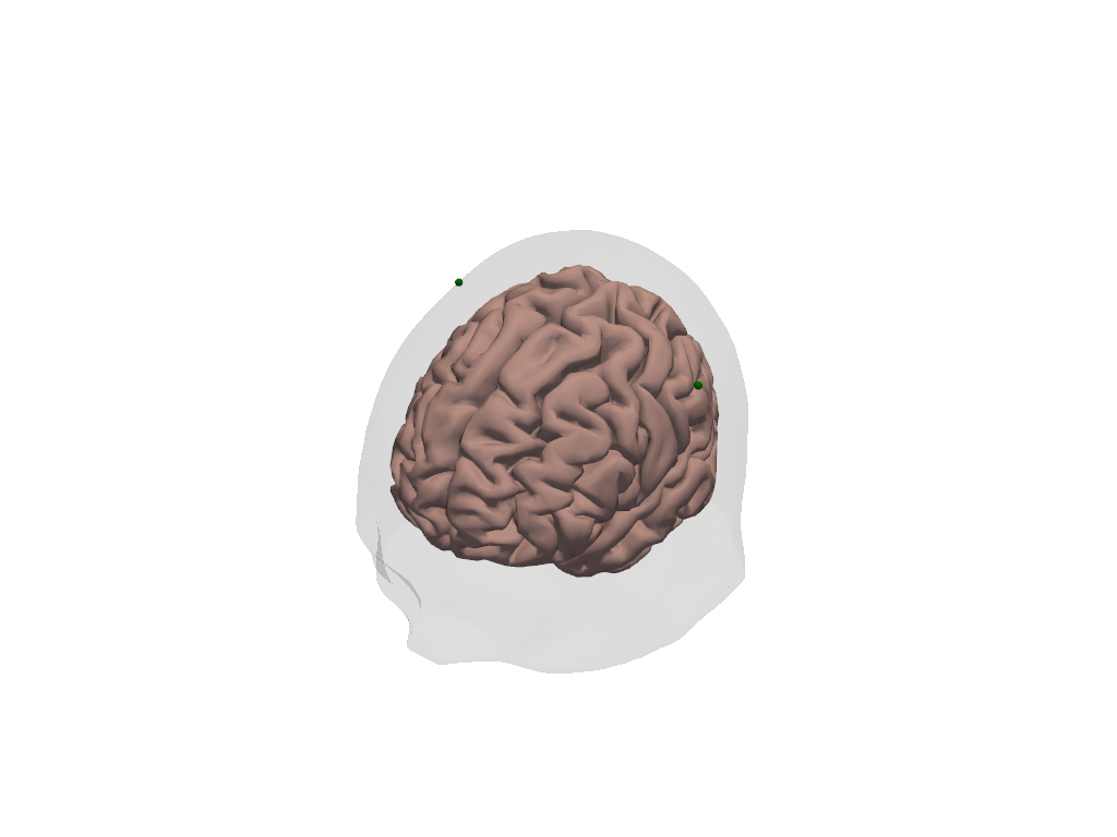 ../../_images/examples_augmentation_62_synthetic_hrfs_example_18_0.png