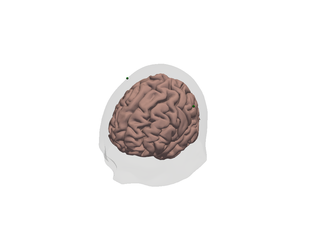 ../../_images/examples_augmentation_62_synthetic_hrfs_example_19_0.png