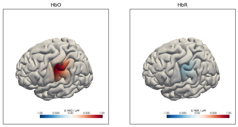 ../../_images/examples_augmentation_62_synthetic_hrfs_example_24_1.png