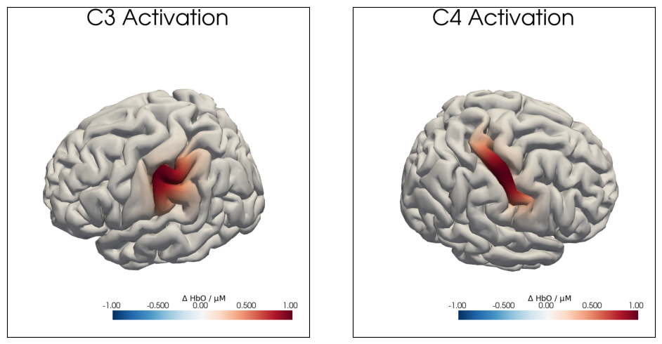../../_images/examples_augmentation_62_synthetic_hrfs_example_32_0.png