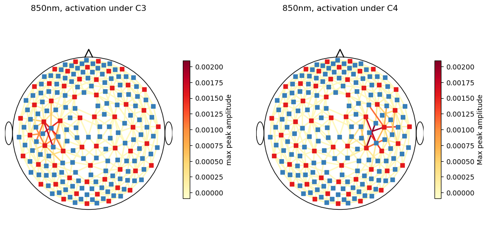 ../../_images/examples_augmentation_62_synthetic_hrfs_example_46_0.png