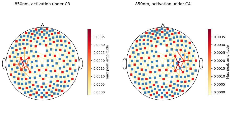 ../../_images/examples_augmentation_62_synthetic_hrfs_example_47_1.png