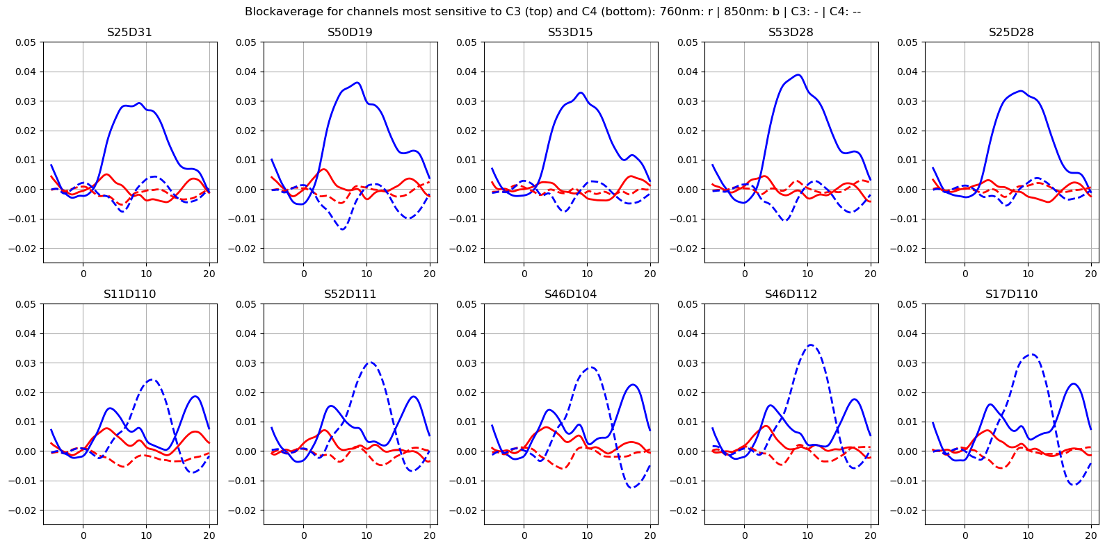 ../../_images/examples_augmentation_62_synthetic_hrfs_example_62_0.png