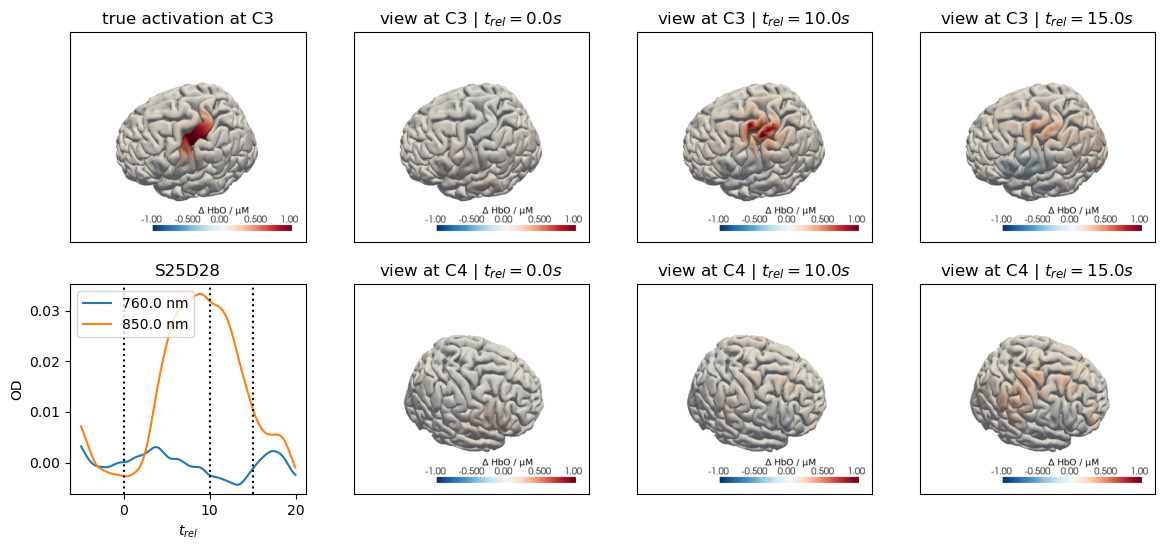 ../../_images/examples_augmentation_62_synthetic_hrfs_example_68_0.png