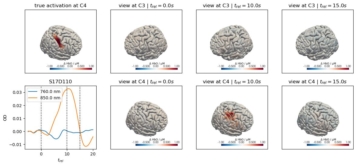 ../../_images/examples_augmentation_62_synthetic_hrfs_example_68_1.png