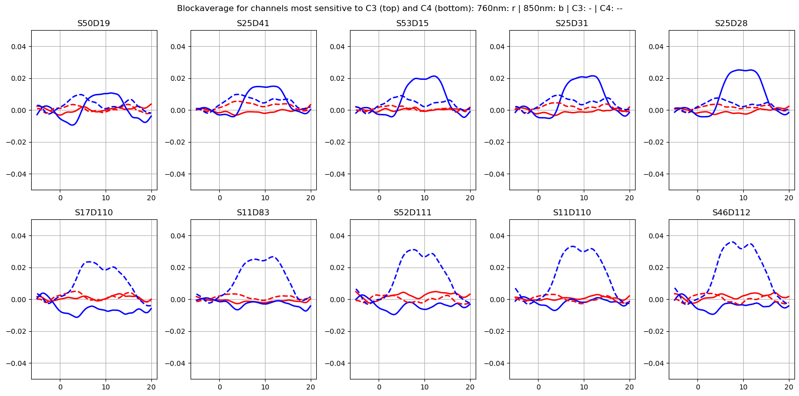 ../../_images/examples_augmentation_62_synthetic_hrfs_example_71_0.png