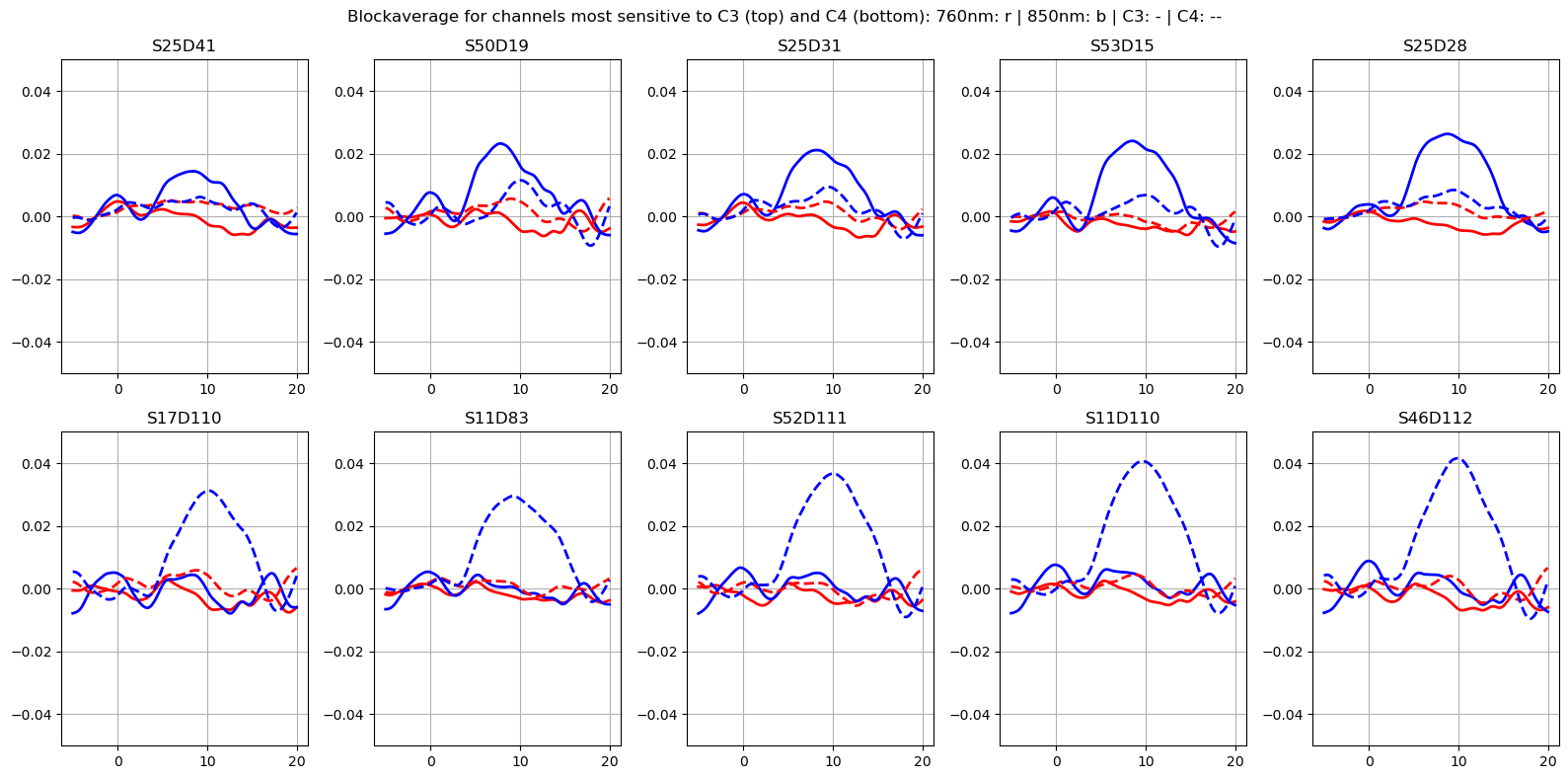 ../../_images/examples_augmentation_62_synthetic_hrfs_example_72_0.png