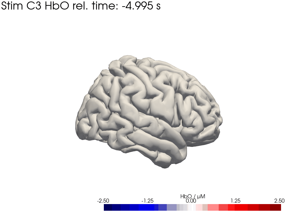 ../../_images/examples_augmentation_62_synthetic_hrfs_example_77_1.png