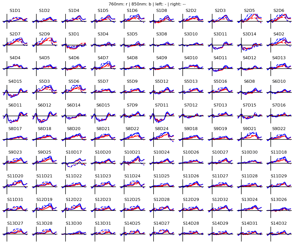 ../../_images/examples_head_models_40_image_reconstruction_19_0.png