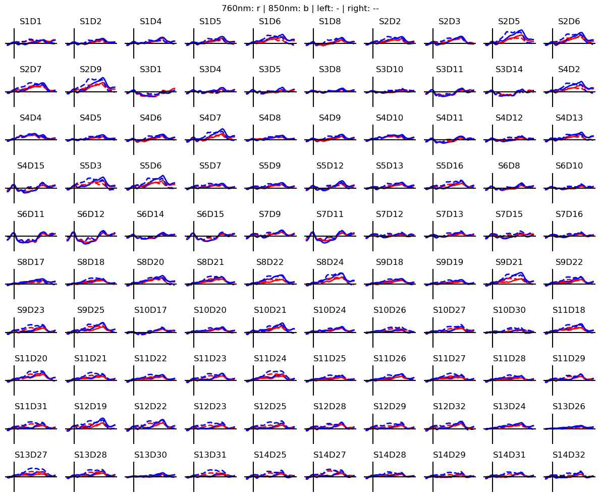 ../../_images/examples_head_models_40_image_reconstruction_23_0.png