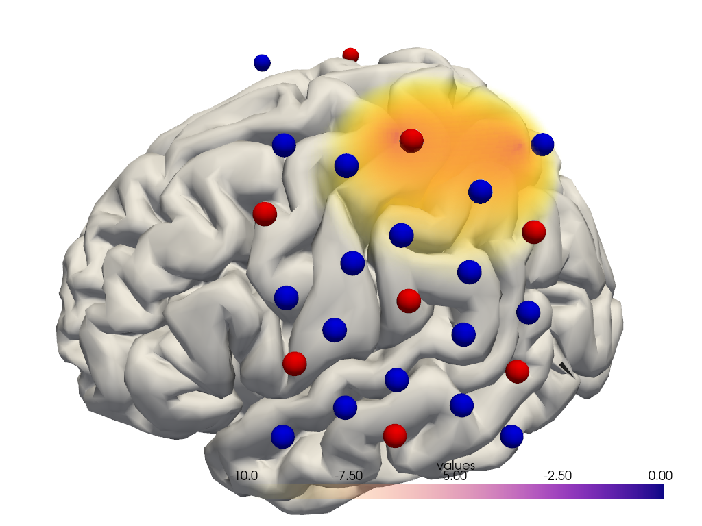 ../../_images/examples_head_models_40_image_reconstruction_49_1.png