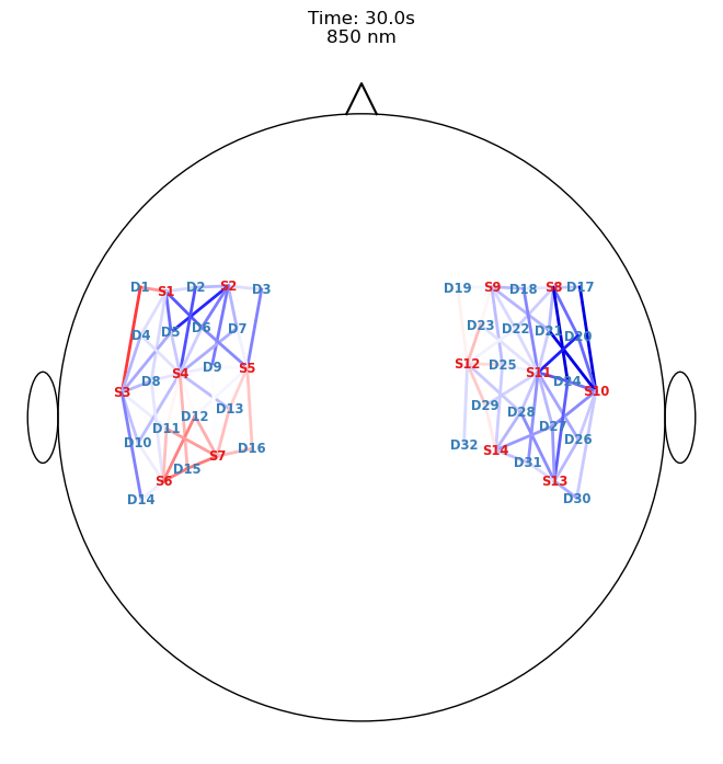 ../../_images/examples_head_models_40_image_reconstruction_68_0.png