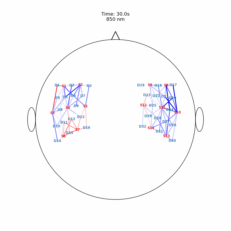 ../../_images/examples_head_models_40_image_reconstruction_69_0.png