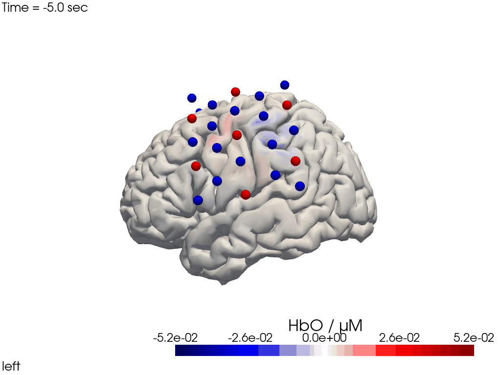 ../../_images/examples_head_models_40_image_reconstruction_71_0.png
