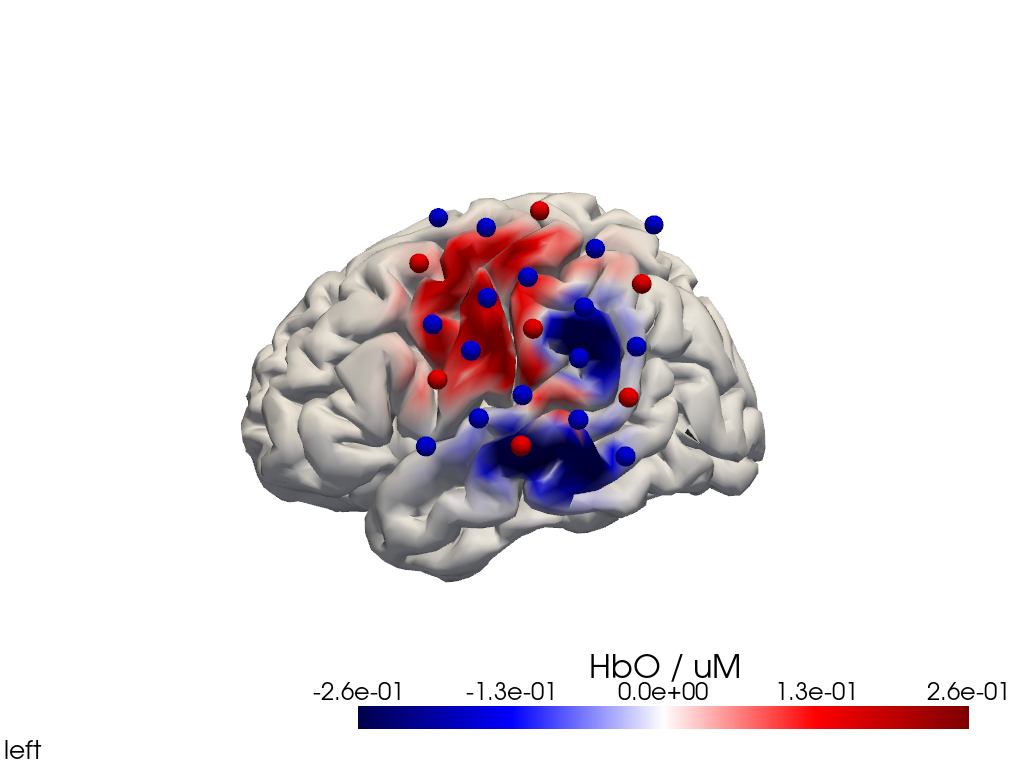 ../../_images/examples_head_models_40_image_reconstruction_74_0.png