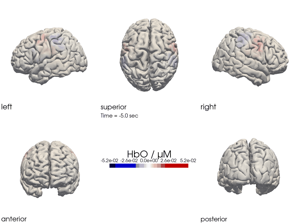 ../../_images/examples_head_models_40_image_reconstruction_77_0.png