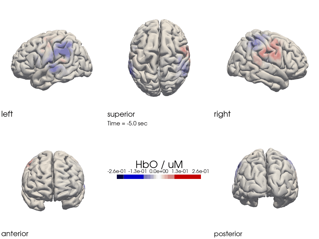 ../../_images/examples_head_models_40_image_reconstruction_78_0.png
