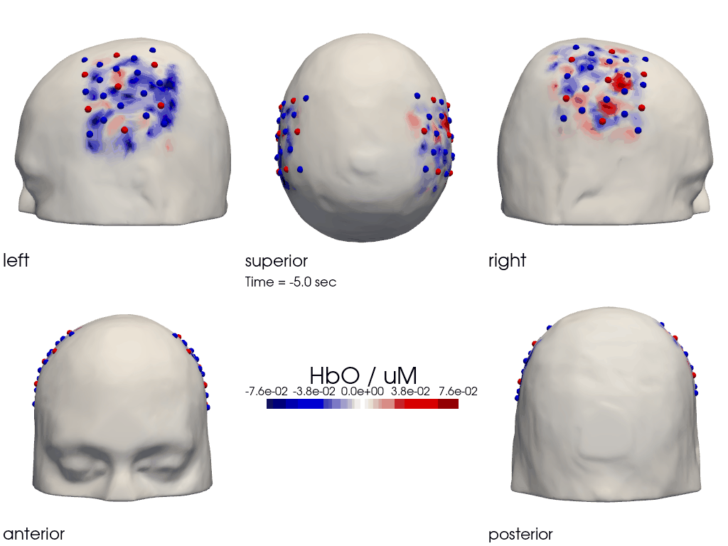 ../../_images/examples_head_models_40_image_reconstruction_79_0.png