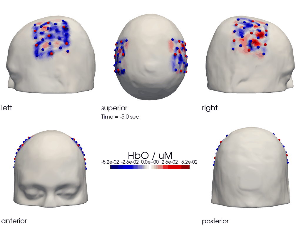 ../../_images/examples_head_models_40_image_reconstruction_80_0.png