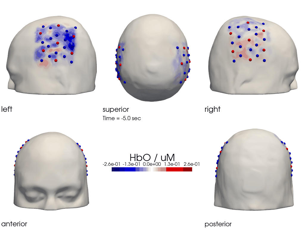 ../../_images/examples_head_models_40_image_reconstruction_81_0.png
