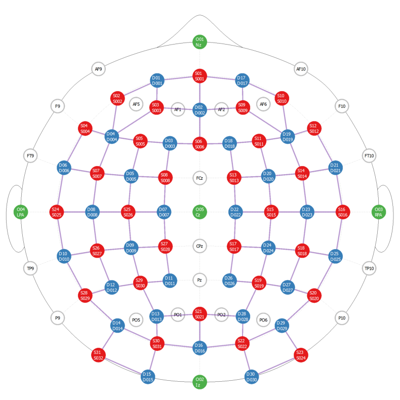 ../../_images/examples_head_models_41_photogrammetric_optode_coregistration_41_0.png