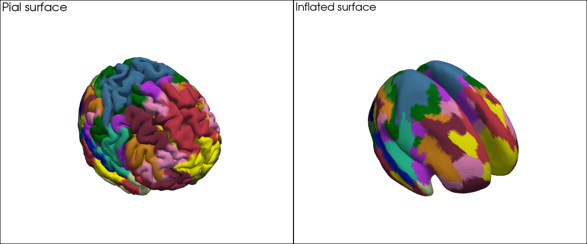 ../../_images/examples_head_models_43a_head_models_overview_27_0.png
