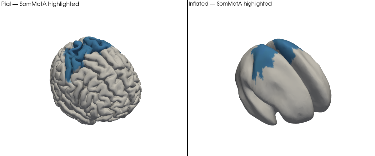 ../../_images/examples_head_models_43a_head_models_overview_30_0.png