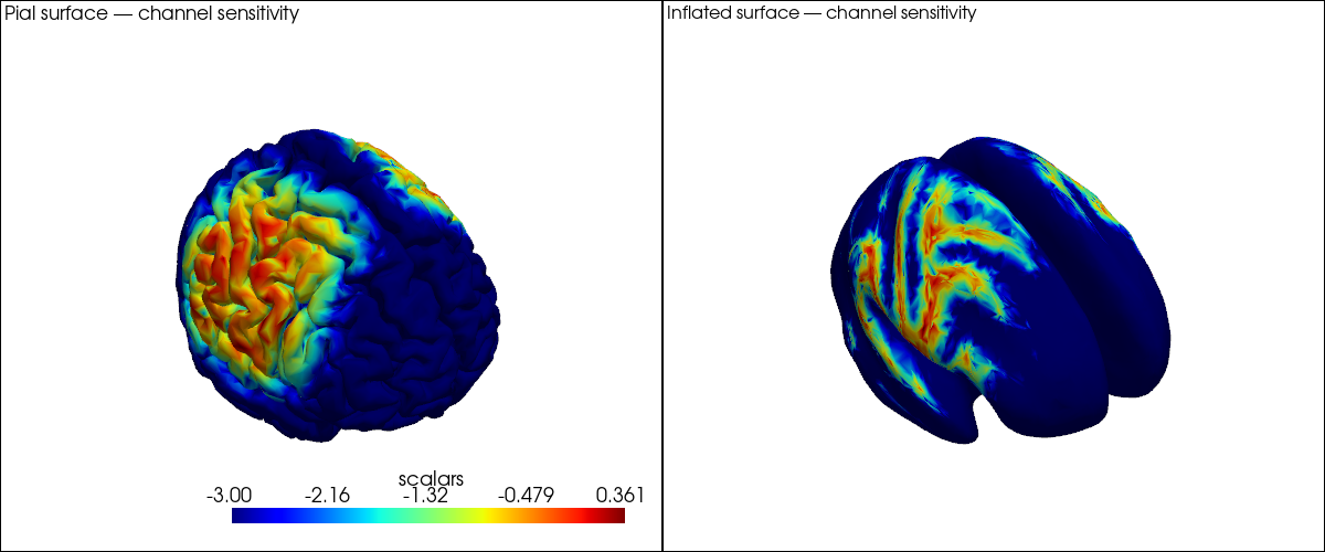 ../../_images/examples_head_models_43a_head_models_overview_39_0.png