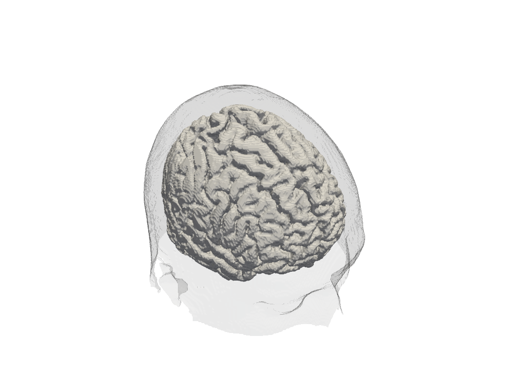 ../../_images/examples_head_models_43b_individualized_head_models_12_0.png
