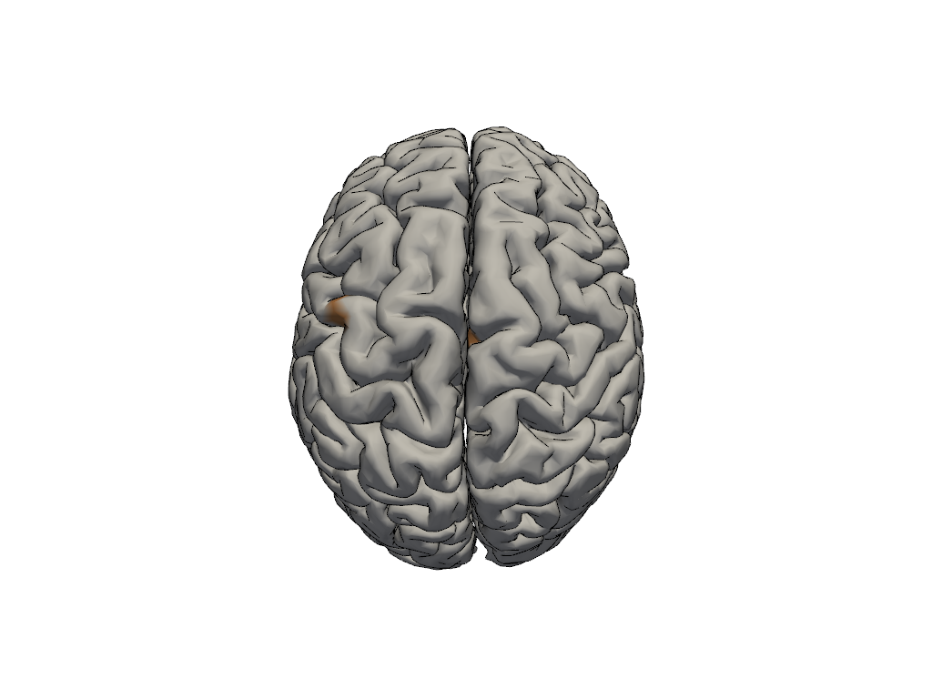 ../../_images/examples_head_models_43b_individualized_head_models_24_1.png