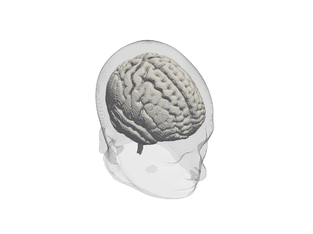 ../../_images/examples_head_models_43b_individualized_head_models_28_0.png