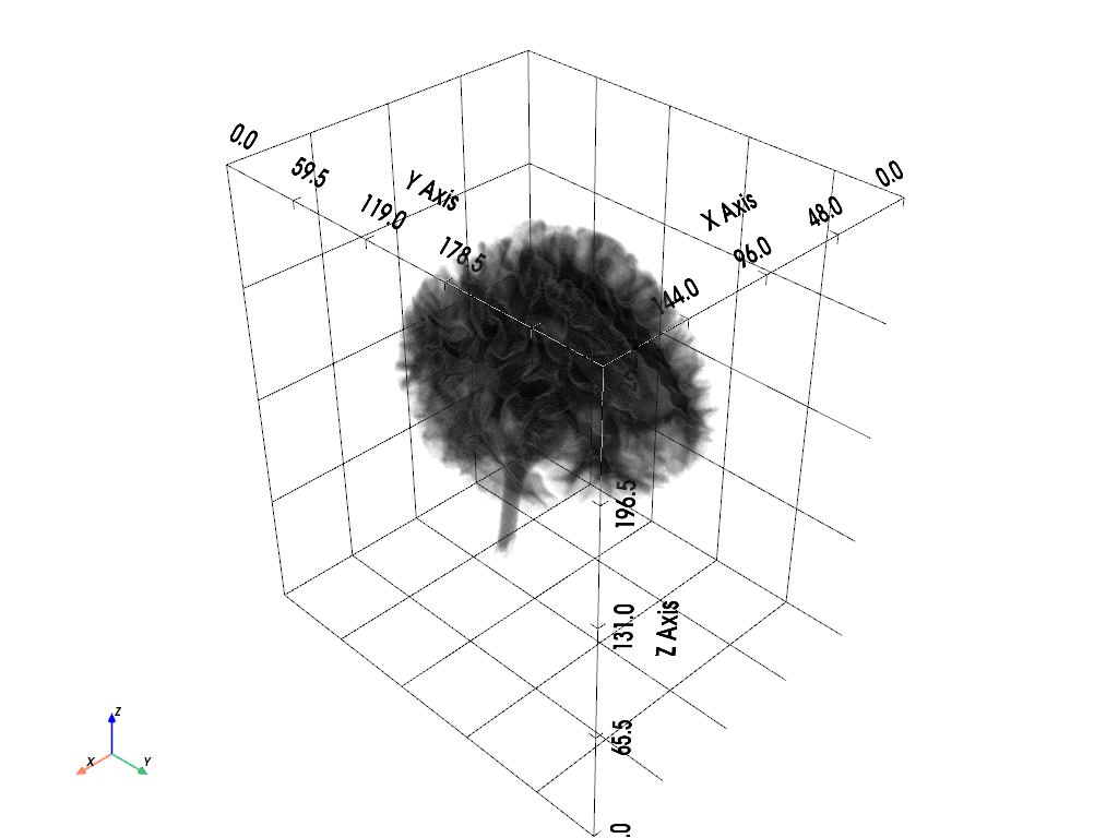 ../../_images/examples_head_models_43b_individualized_head_models_31_0.png