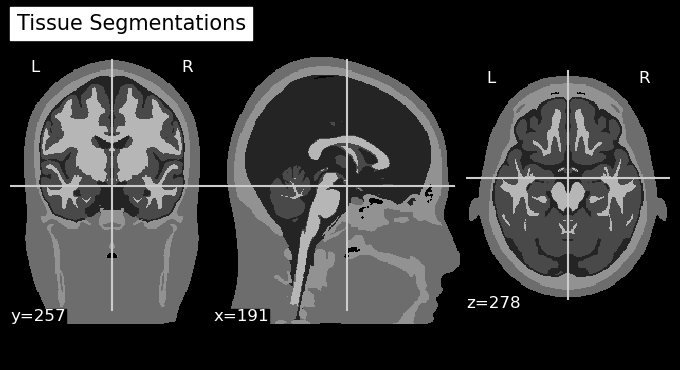 ../../_images/examples_head_models_43b_individualized_head_models_32_1.png
