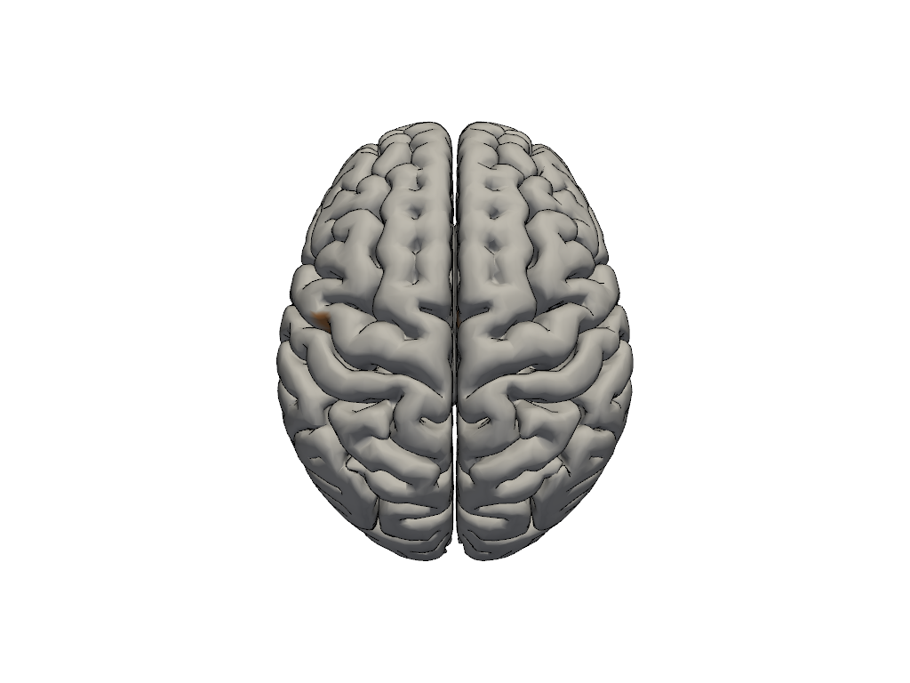 ../../_images/examples_head_models_43b_individualized_head_models_35_1.png