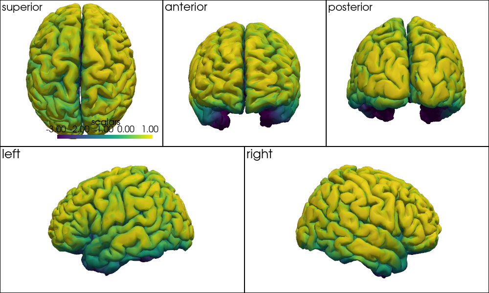 ../../_images/examples_head_models_46_precompute_fluence_9_32.png