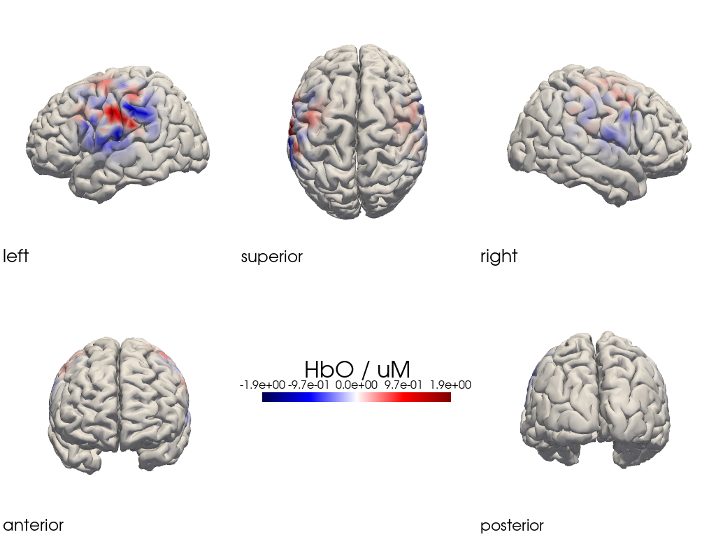 ../../_images/examples_head_models_47_image_reconstruction_regularizations_53_1.png