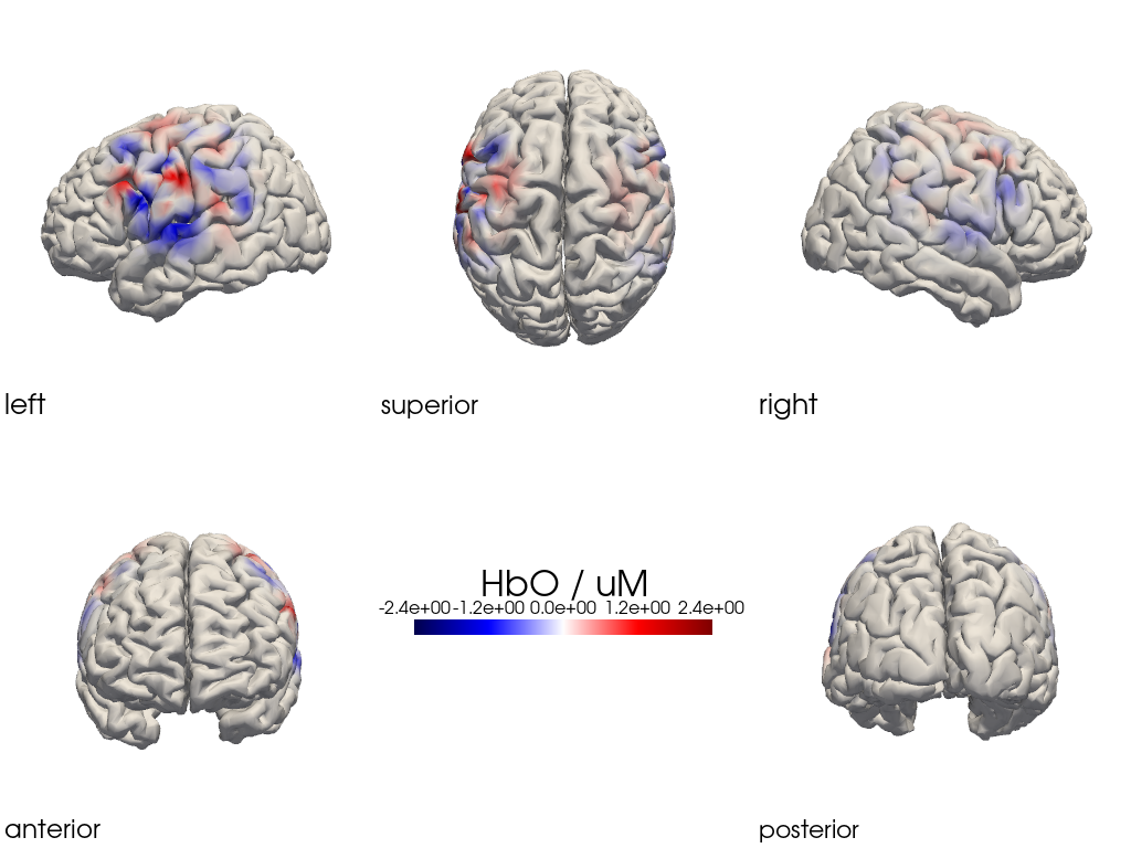 ../../_images/examples_head_models_47_image_reconstruction_regularizations_53_13.png