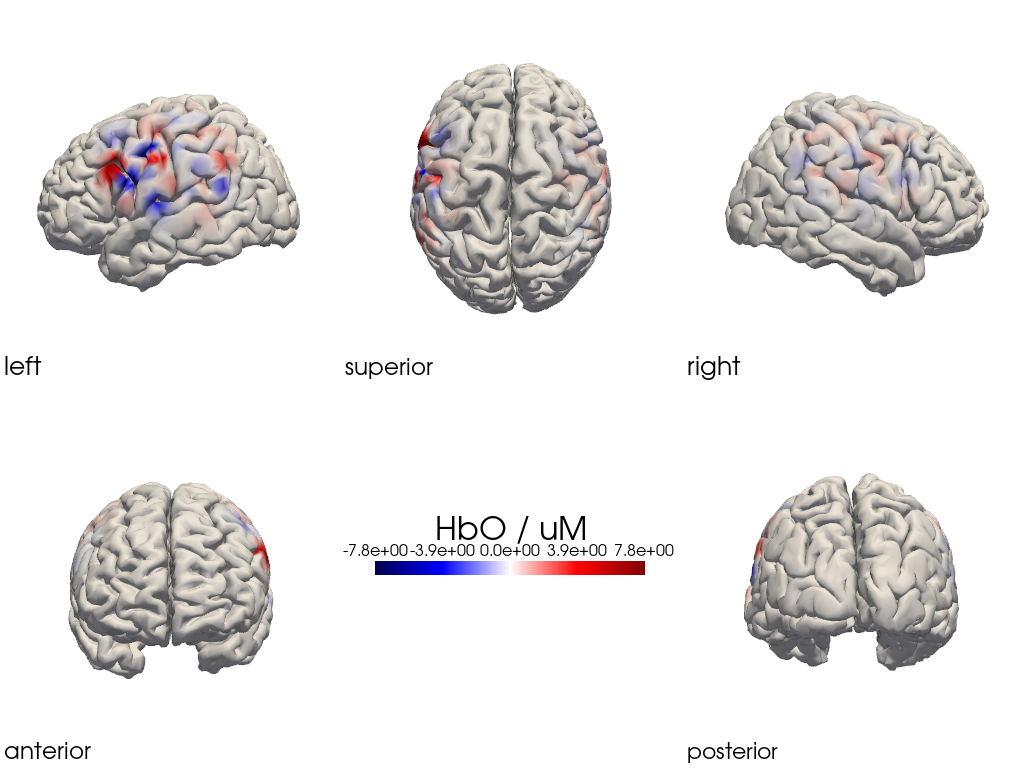 ../../_images/examples_head_models_47_image_reconstruction_regularizations_53_17.png