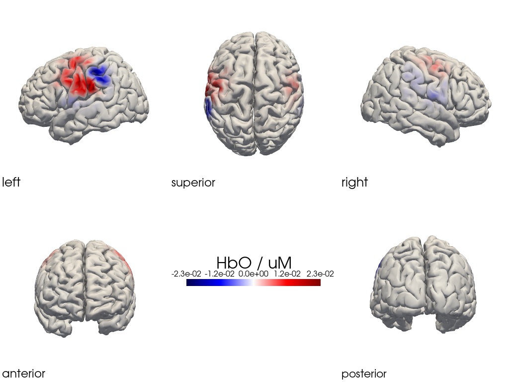 ../../_images/examples_head_models_47_image_reconstruction_regularizations_53_25.png