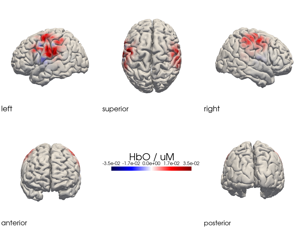 ../../_images/examples_head_models_47_image_reconstruction_regularizations_53_29.png
