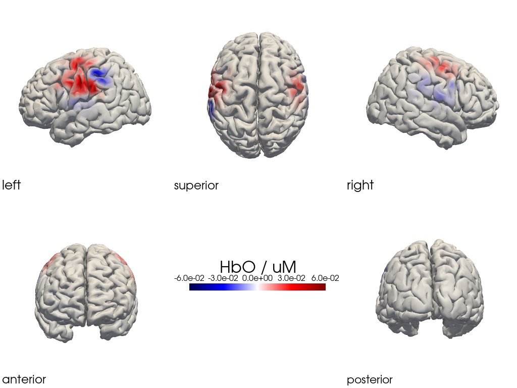 ../../_images/examples_head_models_47_image_reconstruction_regularizations_53_37.png