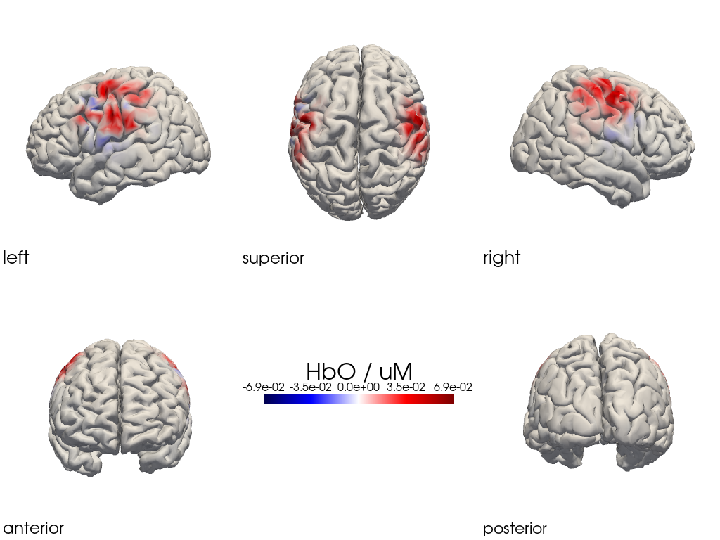 ../../_images/examples_head_models_47_image_reconstruction_regularizations_53_47.png