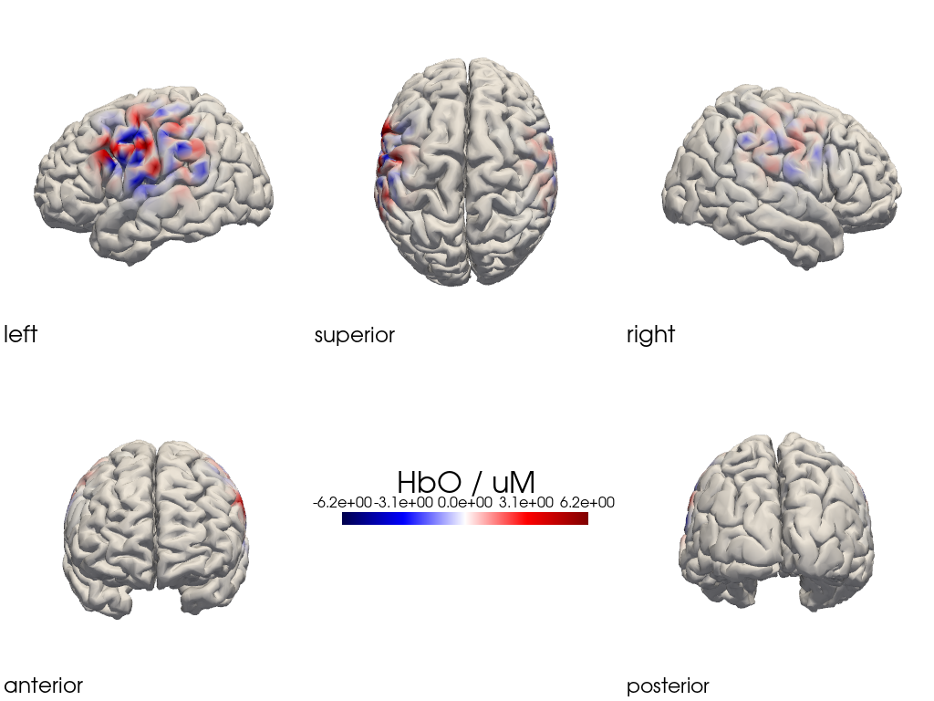 ../../_images/examples_head_models_47_image_reconstruction_regularizations_53_9.png