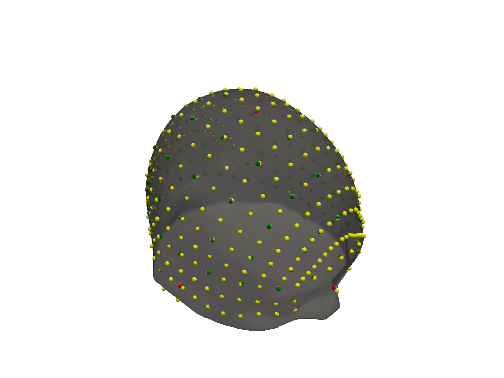 ../../_images/examples_head_models_48_headmodel_landmarks_verification_17_0.png