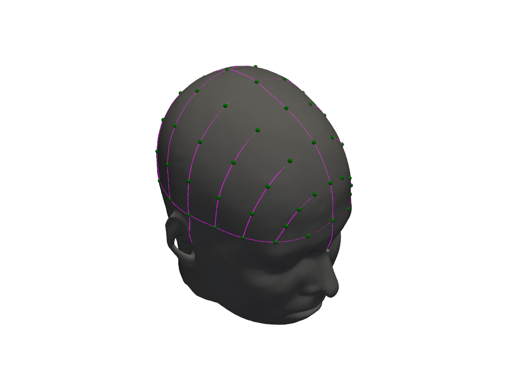 ../../_images/examples_head_models_48_headmodel_landmarks_verification_23_1.png