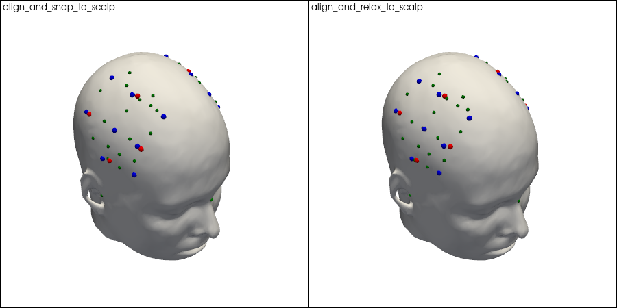 ../../_images/examples_head_models_51_spring_relaxation_registration_10_0.png