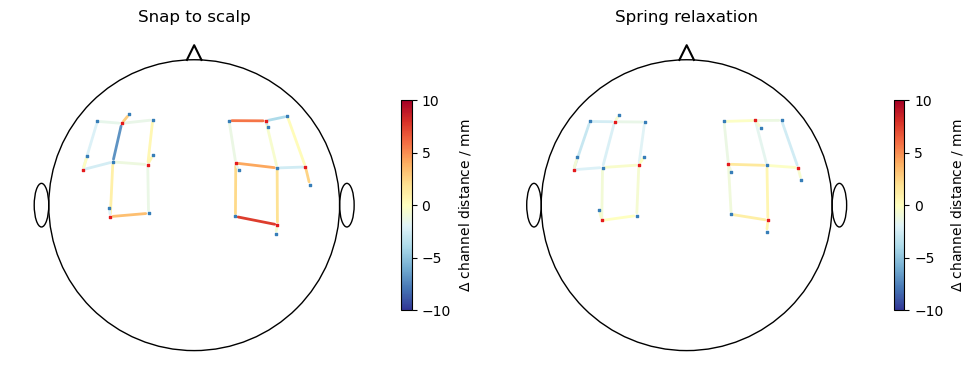 ../../_images/examples_head_models_51_spring_relaxation_registration_12_0.png
