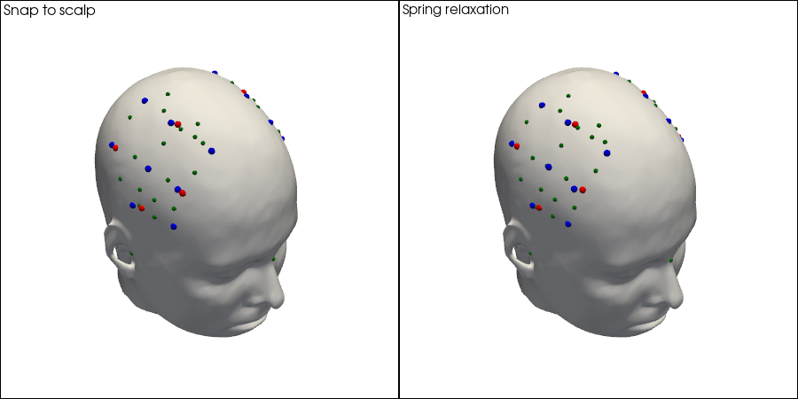 ../../_images/examples_head_models_51_spring_relaxation_registration_21_1.png